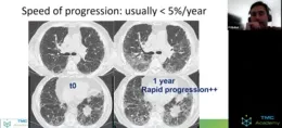 Webinar poster