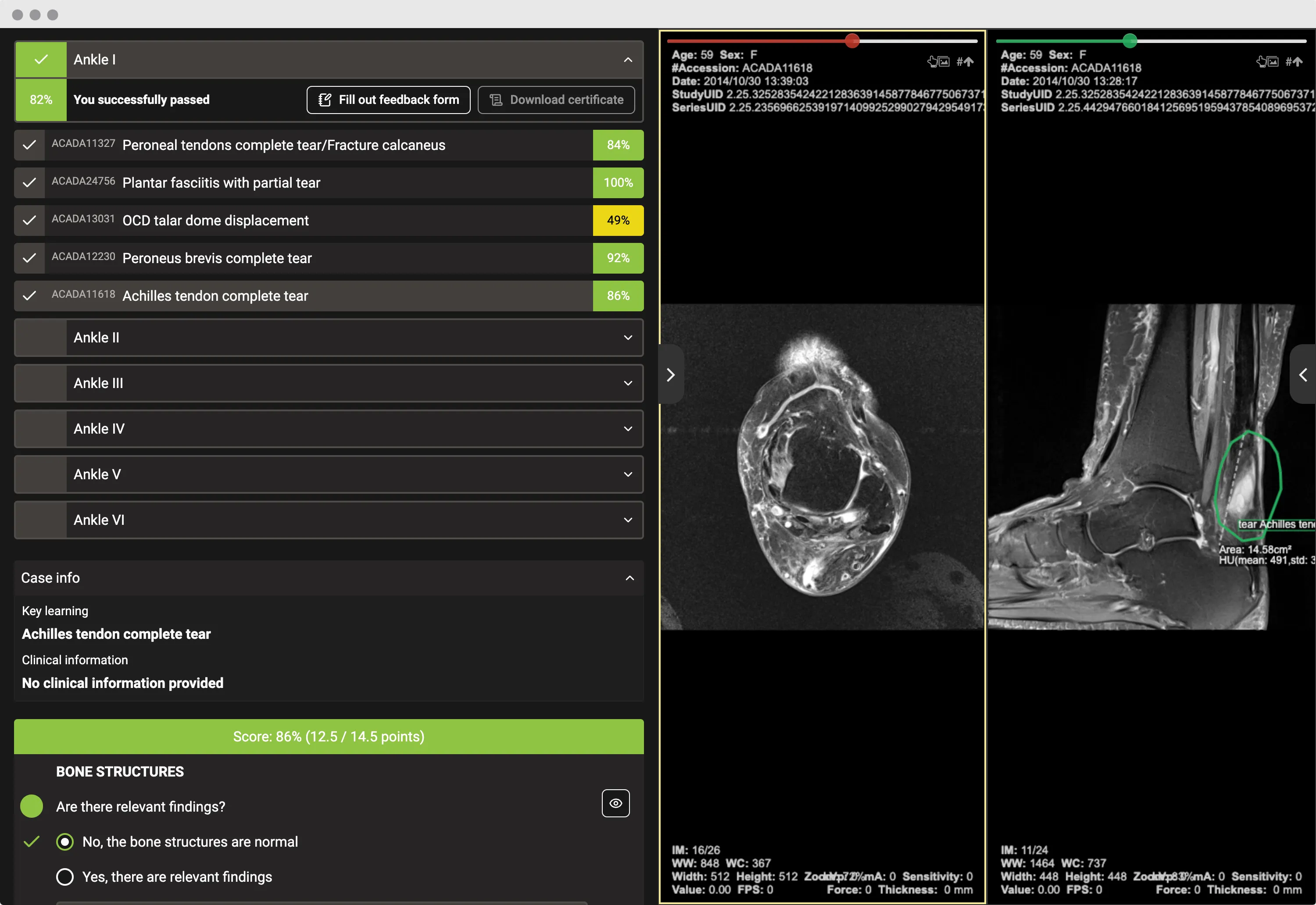 Radiology Reporting Simulator expert feedback interface
